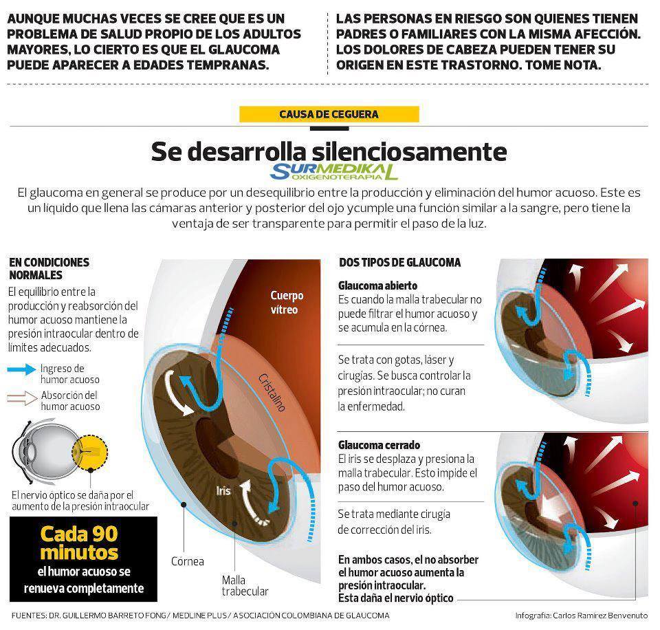 GlaucomaSeDesarrollaLentamente