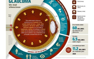 El peligro del Glaucoma
