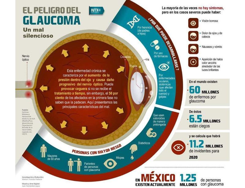 Peligro del Glaucoma
